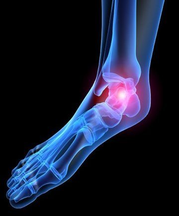 Lorton Podiatrist | Lorton Heel Pain/Fasciitis | VA | Dynamic Foot and Ankle Center |